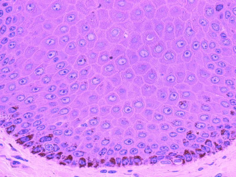 The primary difference between stratum basale and stratum corneum indicates that stratum basale is the bottomless coating of the epidermis. In contrast, the stratum corneum is the most elevated coating of the epidermis. The skin is made up of three coatings which include dermis, epidermis, and hypodermis. Epidermis is the skin's most outer coating, and it safeguards from the incursion of materials into the human body. However, the epidermis consists of many coatings related to the stratum basale, stratum spinosum, stratum lucidum, stratum granulosum, and stratum corneum. The stratum basale is the bottomless coating of the skin's epidermis, whereas the stratum corneum is the most elevated coating of the skin's epidermis.