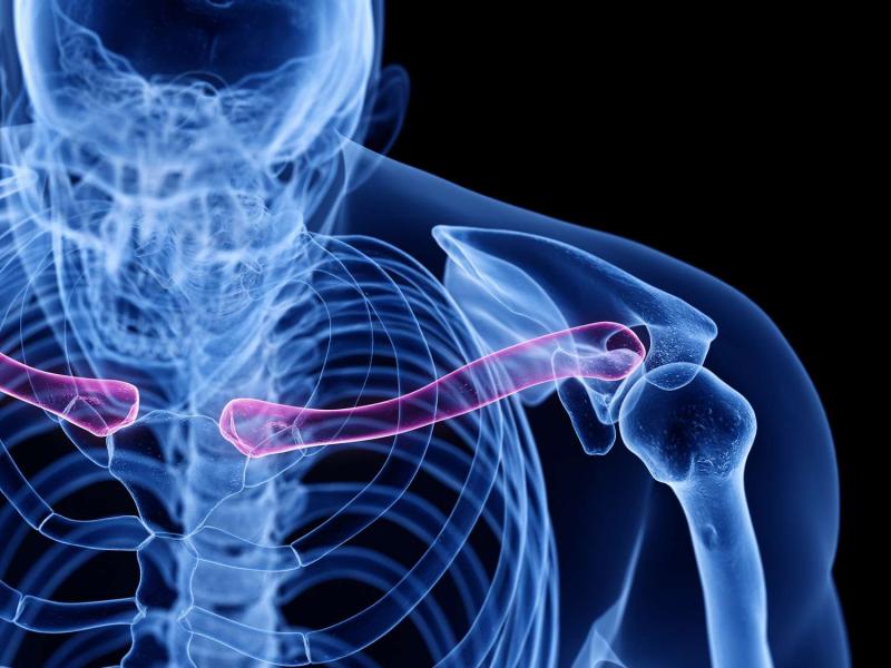 The significant difference between male and female clavicles shows males naturally possess a more dense and straighter clavicle, whereas females have a more V- clavicle. The clavicle, which is familiarly described as the collar bone, is a long bone that lengthens between the sternum's manubrium and the scapula's acromion. It possesses three significant functions: connecting the upper limb to the trunk, safeguarding underlined cardiovascular arrangements, and sending force from the upper limb. Anatomically, there is a difference between the male and the female clavicle. This difference is essential in areas such as forensic research.