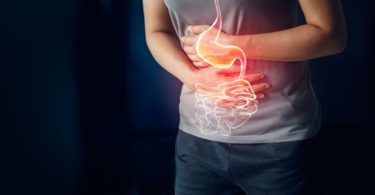 Gastritis is described as the inflammation of the gastric mucosa. It is fundamentally a histological analysis, even though it is a lot of time discovered at upper gastroesophageal endoscopy known as UGIE. Based on the beginning of the ailment procedures, it is classified as acute and chronic gastritis.