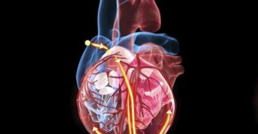 The significant difference between fibrillation and defibrillation shows that fibrillation is accountable for improved pulse rate, whereas defibrillation is accountable for decreased pulse rate during irregular heart disorders.