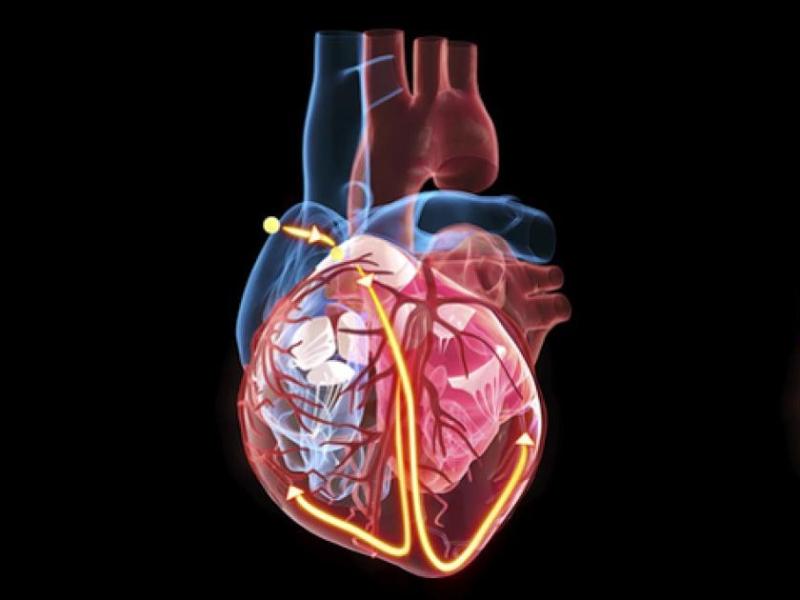 The significant difference between fibrillation and defibrillation shows that fibrillation is accountable for improved pulse rate, whereas defibrillation is accountable for decreased pulse rate during irregular heart disorders.