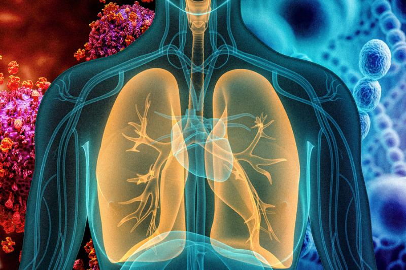 Chest infection is an expansive phrase that encircles any parasitic, fungal, bacterial, or viral infection that occurs anywhere in the respiratory system and has to do with the upper and lower respiratory tract.