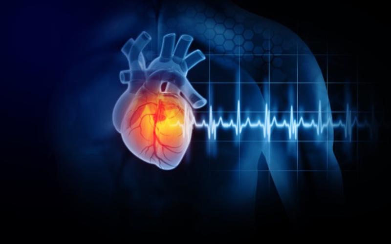 Difference Between Ischemic Heart Disease and Myocardial Infarction